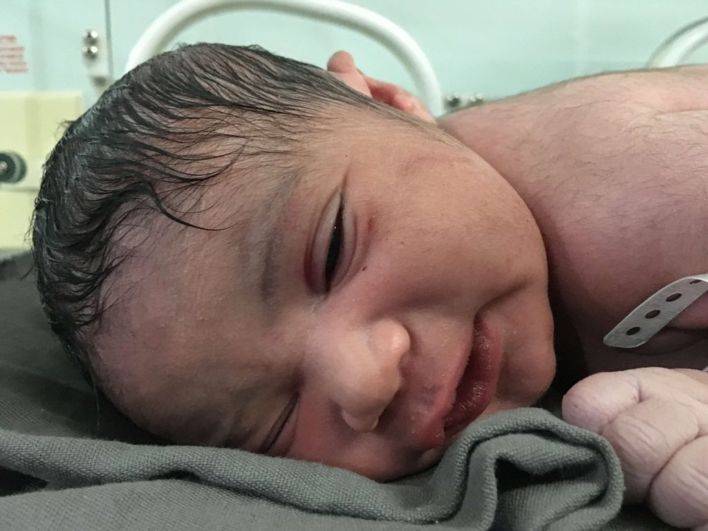 Parto respeitoso; parto cesárea intra-parto; parto na penumbra