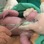 Parto Humanizado; parto respeitoso; parto natural; parto no PPP