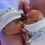 Parto humanizado; parto normal; parto na penumbra; parto respeitoso; Parto Gemelar; Parto de gêmeos; parto hospitalar