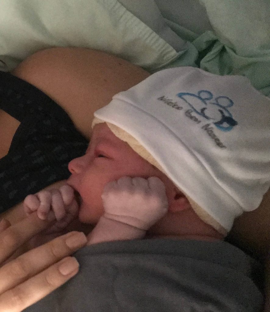 Parto Natural, Parto humanizado; parto normal; parto na penumbra; parto respeitoso; Parto de cócoras; Parto com kiwi, Parto com vácuo-extrator