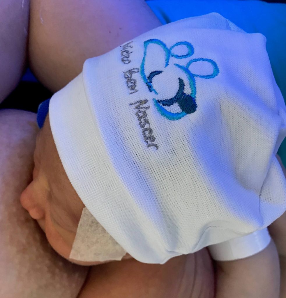 Parto humanizado; parto normal; parto na penumbra; parto respeitoso; Parto à Fórceps de Alívio; Parto sob analgesia; Pele a pele