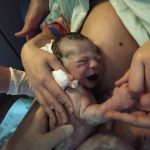 Parto Normal Pós Cesárea Prévia; Parto humanizado; parto normal; parto na penumbra; parto respeitoso; Parto no banquinho de parto; Parto na banqueta de parto; parto em suíte