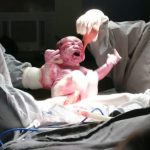 Parto na penumbra; parto humanizado; parto cesariana; parto respeitoso; parto cesárea; cesárea humanizada; Bem-Nascida