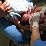 Bem-nascido; Parto normal pós cesarea; parto humanizado; parto normal; Parto respeitoso; parto sob anestesia