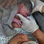 Birth; parto humanizado; parto cesariana; parto respeitoso; bem-nascida; parto cesárea