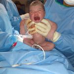 Parto na penumbra; BIRTH; parto humanizado; parto cesariana; parto respeitoso; parto cesárea; cesárea intra-parto; Bem-Nascida