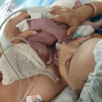 Parto Cesáreo; Parto Humanizado; Parto Respeitoso; Bem-Nascido; BIRTH; Parto na penumbra; Parto Leboyer