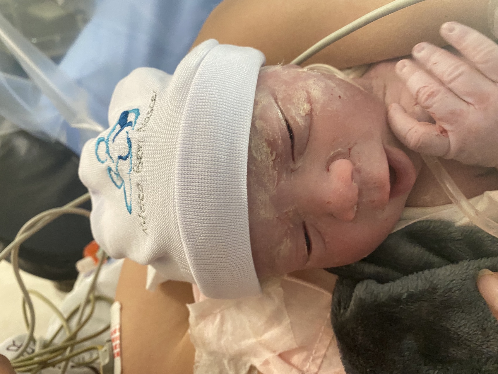 Parto Cesáreo; Parto Humanizado; Parto Respeitoso; Bem-Nascido; BIRTH; Parto na penumbra; Parto Leboyer