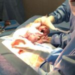 Parto Cesáreo; Parto Humanizado; Parto Respeitoso; Bem-Nascida; BIRTH; Parto na penumbra; Parto Leboyer; iterativa