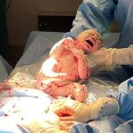 Parto Humanizado; Parto Respeitoso; Parto NBN; Bem-Nascida; Parto na penumbra; BIRTH; Cesárea a pedido; Parto; #8M